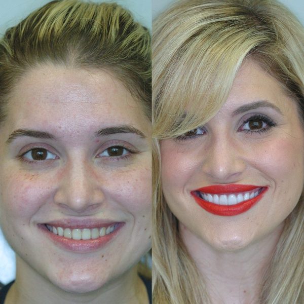 Cosmetic-Dentistry-_Before-After.jpg