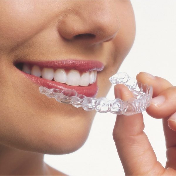 Invisalign-Benefits.jpg
